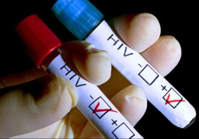Выявляются «запущенные» случаи: ВИЧ-инфекцией в Самарской области заражены практически 35 тыс. человек