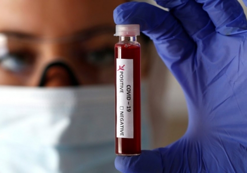 Вирусолог предупреждает о новых вспышках коронавируса из Европы